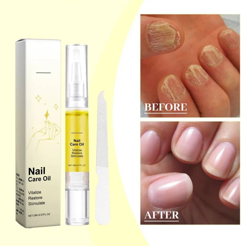 Nail Growth Oil for Hydration & Cuticle Strengthening Natural Nail Health Care