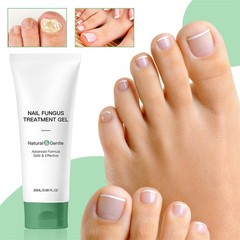 Nutraboost Nail Fungus Treatment Gel, Nail Fungus, Fungus Cream NEW 2026