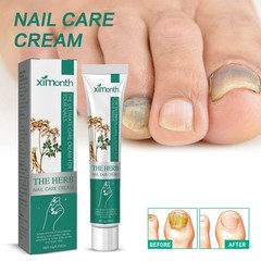 Nail Repair Cream Fungal Toenail Treatment Thickened Soft Nail Ingrown Care