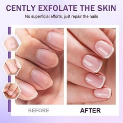3-in-1 Cuticle Oil Pen, Cuticle Pusher Nail Oil Pen with Ceramic Tip, 2pcs