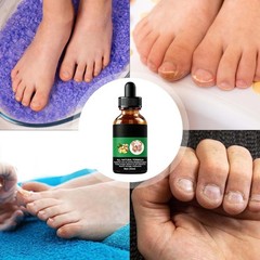 Toe Nail Care Liquid 50ml Fast Absorption Lightweight Gentle for All Skin Types