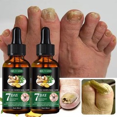 2 Pack Nail Nutrient Solution Nail &amp; Cuticle Care Oil Moisturizing 30ml