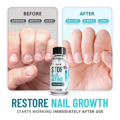 Stop Nail Biting Treatment for Kids & Adults – Bitter Taste No-Bite Nail Polish,