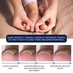 Nail Daily Care Oil for Ingrown Toenails on Hands Feet Toenails Anti Fungal
