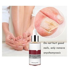 Nail Repair Essence 15ml, Remove Onychomycosis Serum Fungal Nail
