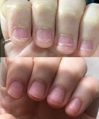Magickal Nail Growth Oil- for Long and Strong Nail Growth – All Natural