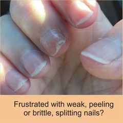 FlexiNail Penetrating Fingernail 1 Count (Pack of 2), light golden yellow