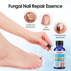 30ml Nail Repair Oil Fungal Nail Treatment Liquid Remove Toe Nail Fungus Essence