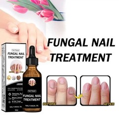 Nail Repair Liquid Thickening Brightening and Moisturizing Nail Care Solution