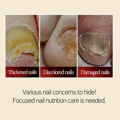 MEDIPICKME Safepick Intensive Nail Strengthener Serum 0.57 Fl Oz (Pack of 1)