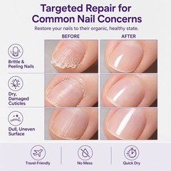Qlear Beauty Keratin Nail Pen, Cuticle Repair Strengthening Nail Serum Treatment