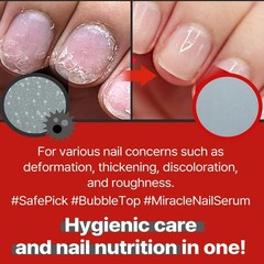 MEDIPICKME Safepick Intensive Nail Strengthener Serum 0.57 Fl Oz (Pack of 1)