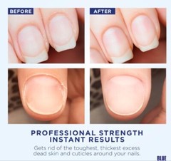 4 – 6 oz Bottles, Blue Cross Professional Nail Care Moisturizing Cuticle Remover