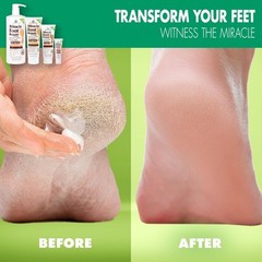 Miracle Foot Repair Cream, (1 oz / 3 Pack) Repairs Dry 1 Ounce (Pack of 3)