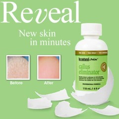 Prolinc Callus Eliminator 4 OZ Original – 2 Pack