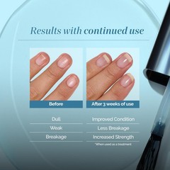 Nail Strengthening & Growth Treatment – Repair, Shine & Protect Weak Brittle Nai