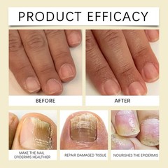 Nail Care Liquid Hand and Foot Nail Corneous Soft Nail