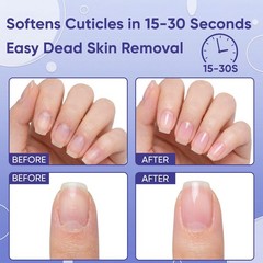 SASSYTIP Cuticle Care Kit – Remover Gel (1oz) & Ceramic Gel+Pink Pen