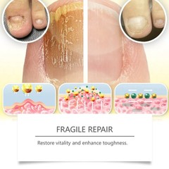 Nail Care Solut Soft Nail Brightening Nail Nourishing Care Solut