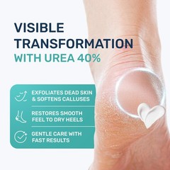 Urea Cream 40 Percent for Feet Maximum Strength 4.3 Fl Oz (Pack of 1), White