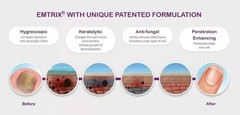 New 3 x EMTRIX Fungal Nail Treatment Visible Results in 1 Week Easy Application