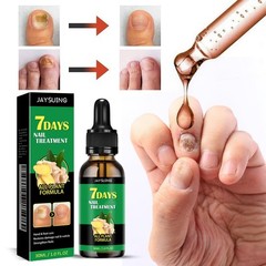 3Pcs Ginger Nail Treatment, 7days Growth 1 Fl Oz (Pack of 2), Yellow