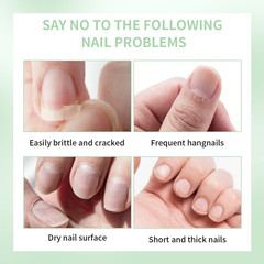 Nail Treat-Growth Cuticle Oil Bright Oil Texture, Repair Damaged Nails- 5 ML