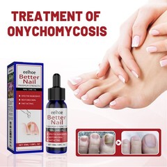 Nail Fungus Treatment Liquid with Moisturizing Formula for Toenail Health