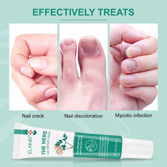 Toenail Plant-Based Care Cream For Discolored or Thickened Toenails