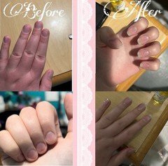 15ml Serum, Made With All Organic Ingredients To Grow And Strengthen Your Nails.
