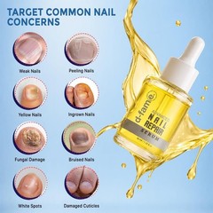Nail Repair Serum With Nail Growth & Anti-Fungal Formula | 30ml