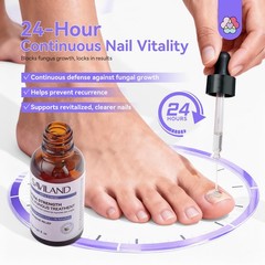SAVILAND Toenail Fungus Treatment Extra Strength: 1 Fl Oz (Pack of 1), clear