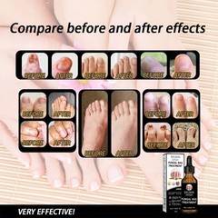 Nail Repair Liquid Thickening Brightening and Moisturizing Nail Care Solution