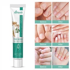 Nail Repair Cream Fungal Toenail Treatment Thickened Soft Nail Ingrown Care