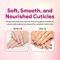 Pro Hydrating Cuticle Remover 4 fl oz – Professional Fast-Acting Cuticle Soft…