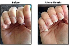 Nail Conditioner Treatment – 3 Pack for Healthy, Strong Nails & Cuticle Care