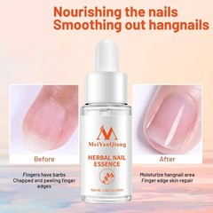 Herbal Toenail Repair Essence Effective Nail Whitening For Women Men P2Y2 _30ml.