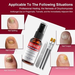 Toenail Fungus Treatment, Treatment Extra Strength with 1 Fl Oz (Pack of 5)