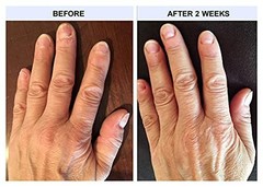 Nail Conditioner Treatment – 3 Pack for Healthy, Strong Nails & Cuticle Care