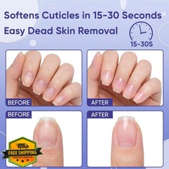 SASSYTIP Cuticle Remover Gel Clear