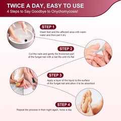 Toenail Fungus Treatment, Treatment Extra Strength with 1 Fl Oz (Pack of 5)