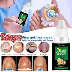 Extra Strong Nail Fungus Treatment Serum Essence Oil Feet Nails Repair Care Esse