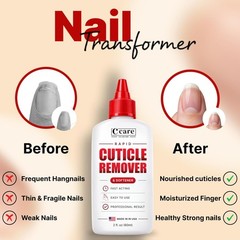 Professional Cuticle Remover 2oz – Rapid Gel, Hydrating Aloe, Almond Oil Formula