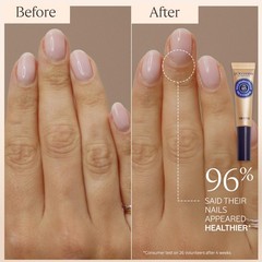 Nourishing Shea Nail & Cuticle Oil – Hydrating Brush-On Moisture for Stronger Na