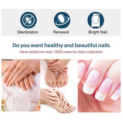 ANTI FUNGAL NAIL REPAIR LIQUID INFECTION ANTIBACTERIAL TOE FINGER TREATMENT-AU