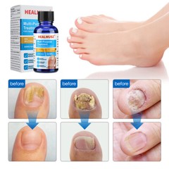30ml Nail Repair Oil Fungal Nail Treatment Liquid Remove Toe Nail Fungus Essence