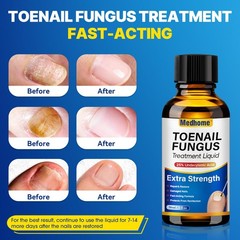 Medhome Toenail Fungus Treatment Extra Strength – 1 Fl Oz (Pack of 1), Brown