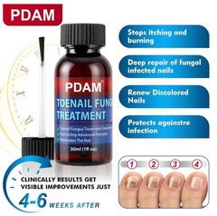 PDAM Toenail Fungus Treatment Liquid w/ Undecylenic Acid & Tolnaftate 30ml