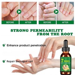 Natural Fingernail Essence Oil Nail Growth Strengthener Fungus Treatment Care