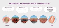 EMTRIX Fungal Nail Treatment ( 10ml ) X 2
